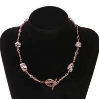 Neck25.384765825_czez